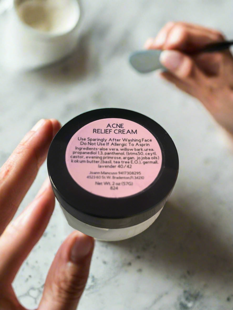 Acne Relief Cream